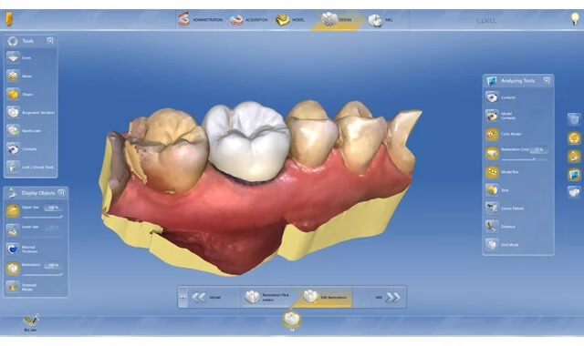 One Day Tooth Crown Technology